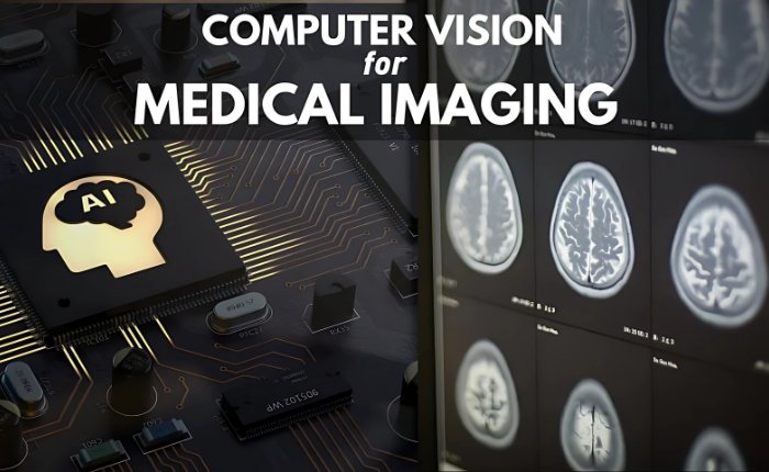 Personalised Computer Vision